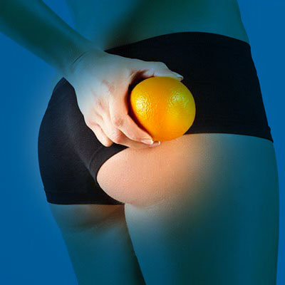 cellulite-rienzione