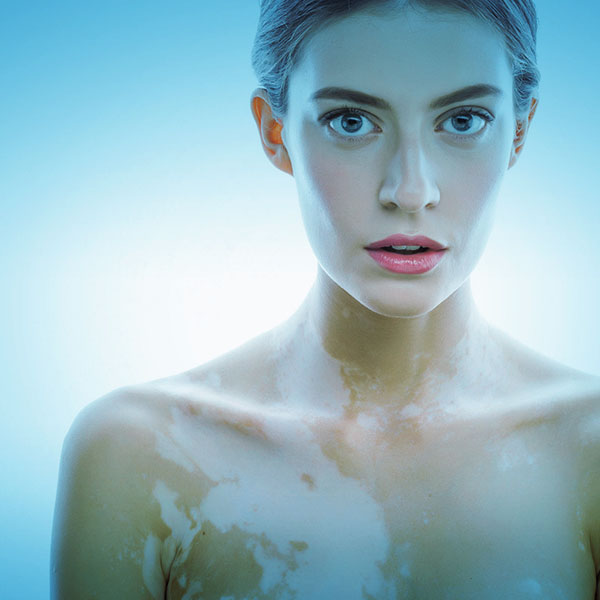 vita365-patologie-dermatologiche